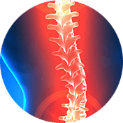 spinal deformity circle