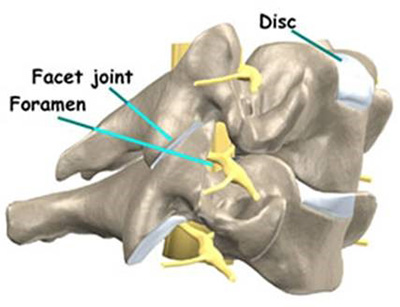 posterior cervical laminoforaminotomy 1