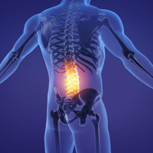 Painful,Lumbar,Spine.,3d,Illustration. Painful,Lumbar,Spine.,3d,Illustration.