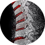 spine-trauma